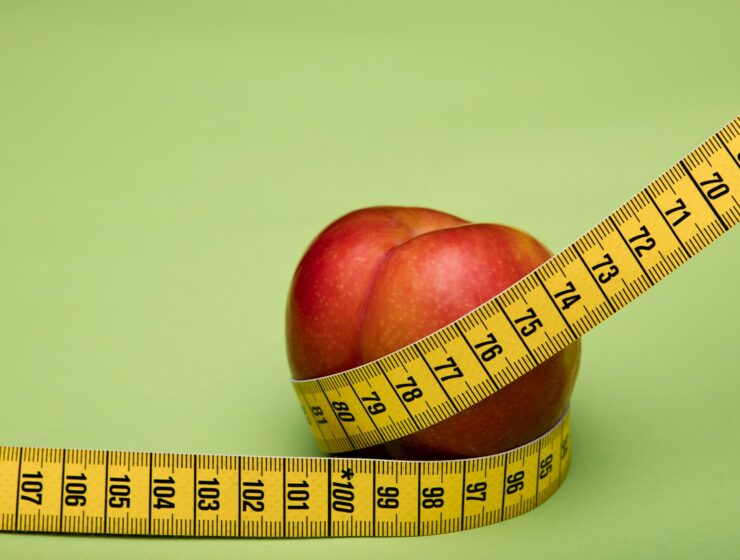 obesità cura approccio multidisciplinare